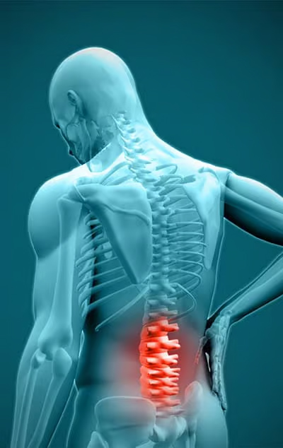 Body stress illustration showing spinal tension